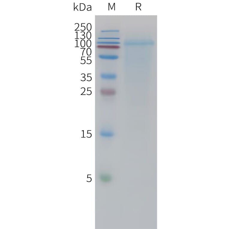SDS-PAGE - Recombinant Human Lingo1 Protein (6xHis Tag) (A325021) - Antibodies.com