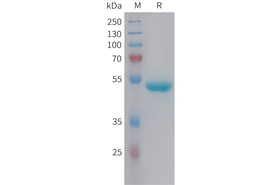 SDS-PAGE - Recombinant Human Lipocalin-2/NGAL Protein (Fc Tag) (A325022) - Antibodies.com