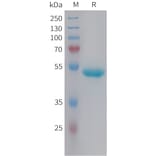SDS-PAGE - Recombinant Human Lipocalin-2/NGAL Protein (Fc Tag) (A325022) - Antibodies.com