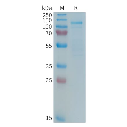 SDS-PAGE - Recombinant Human LRP5 Protein (Fc Tag) (A325023) - Antibodies.com