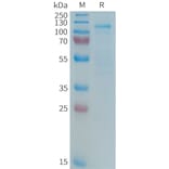 SDS-PAGE - Recombinant Human LRP5 Protein (Fc Tag) (A325023) - Antibodies.com