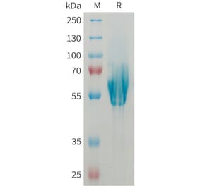 SDS-PAGE - Recombinant Human MAdCAM1 Protein (6xHis Tag) (A325024) - Antibodies.com