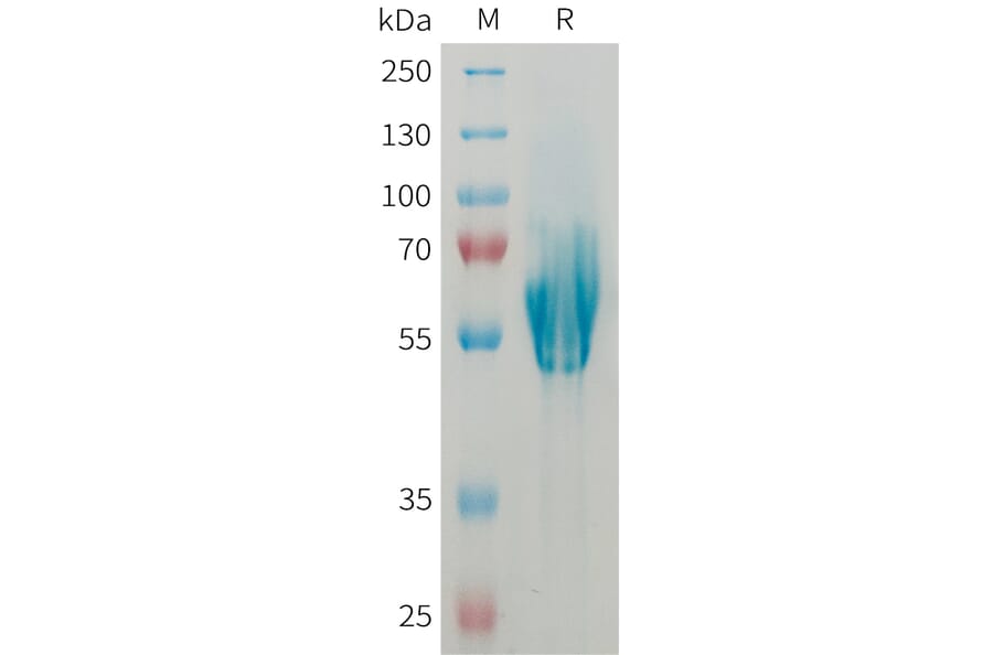 SDS-PAGE - Recombinant Human MAdCAM1 Protein (6xHis Tag) (A325024) - Antibodies.com