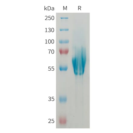 SDS-PAGE - Recombinant Human MAdCAM1 Protein (6xHis Tag) (A325024) - Antibodies.com