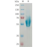 SDS-PAGE - Recombinant Human MAdCAM1 Protein (6xHis Tag) (A325024) - Antibodies.com