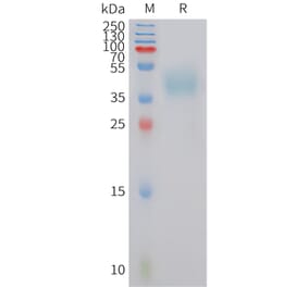 SDS-PAGE - Recombinant Human MC4-R Protein (Fc Tag) (A325026) - Antibodies.com