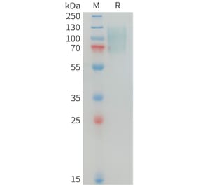 SDS-PAGE - Recombinant Human MERTK Protein (10xHis Tag) (A325027) - Antibodies.com