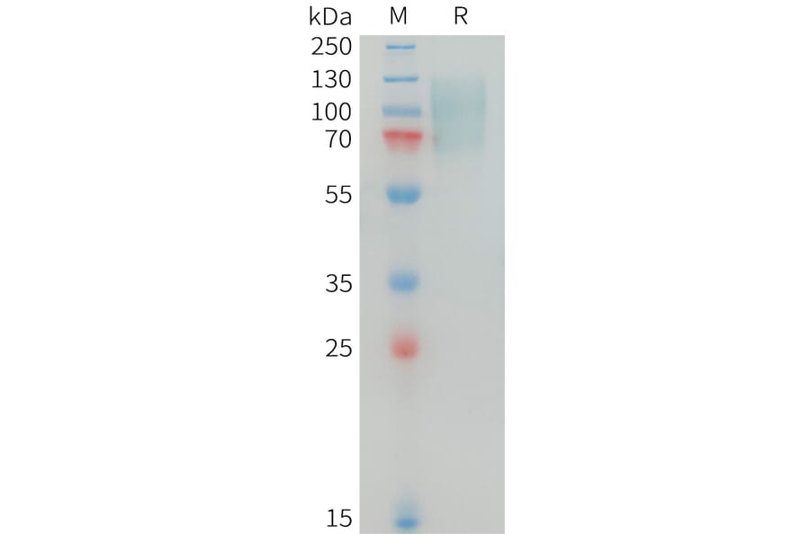 SDS-PAGE - Recombinant Human MERTK Protein (10xHis Tag) (A325027) - Antibodies.com