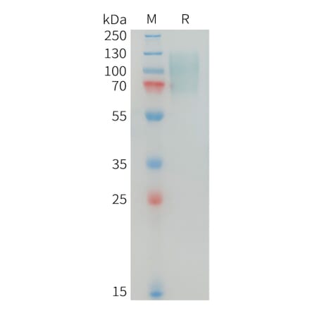 SDS-PAGE - Recombinant Human MERTK Protein (10xHis Tag) (A325027) - Antibodies.com