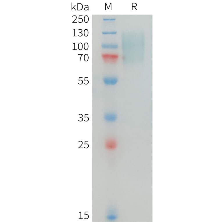 SDS-PAGE - Recombinant Human MERTK Protein (10xHis Tag) (A325027) - Antibodies.com