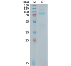 SDS-PAGE - Recombinant Human Met (c-Met) Protein (10xHis Tag) (A325028) - Antibodies.com