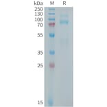 SDS-PAGE - Recombinant Human Met (c-Met) Protein (10xHis Tag) (A325028) - Antibodies.com