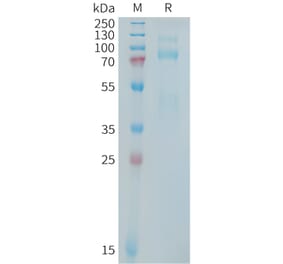SDS-PAGE - Recombinant Human Met (c-Met) Protein (Fc Tag) (A325029) - Antibodies.com
