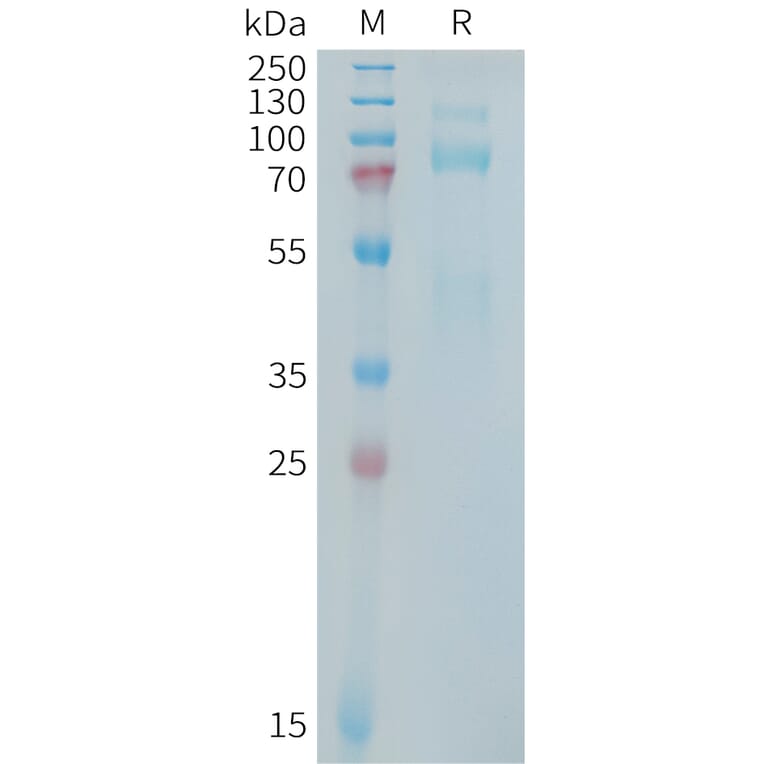 SDS-PAGE - Recombinant Human Met (c-Met) Protein (Fc Tag) (A325029) - Antibodies.com
