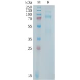 SDS-PAGE - Recombinant Human Met (c-Met) Protein (Fc Tag) (A325029) - Antibodies.com