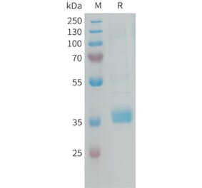 SDS-PAGE - Recombinant Human MFAP4 Protein (6xHis Tag) (A325030) - Antibodies.com