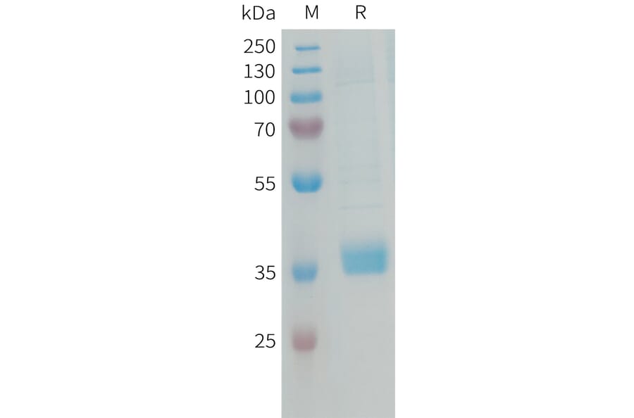 SDS-PAGE - Recombinant Human MFAP4 Protein (6xHis Tag) (A325030) - Antibodies.com