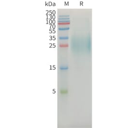 SDS-PAGE - Recombinant Human MICA Protein (6xHis Tag) (A325031) - Antibodies.com
