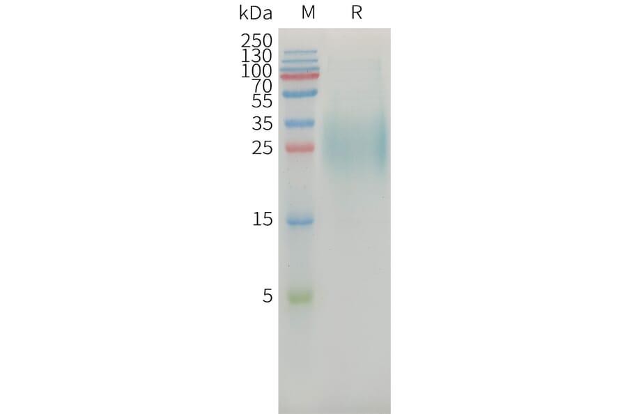 SDS-PAGE - Recombinant Human MICA Protein (6xHis Tag) (A325031) - Antibodies.com