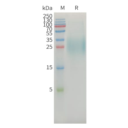SDS-PAGE - Recombinant Human MICA Protein (6xHis Tag) (A325031) - Antibodies.com