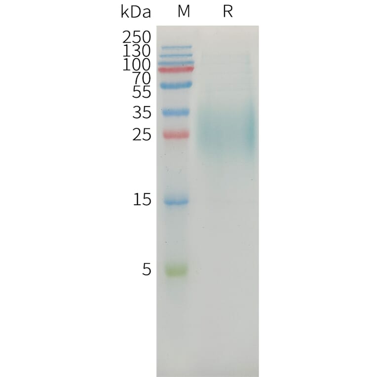 SDS-PAGE - Recombinant Human MICA Protein (6xHis Tag) (A325031) - Antibodies.com