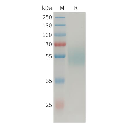 SDS-PAGE - Recombinant Human MICA Protein (Fc Tag) (A325032) - Antibodies.com