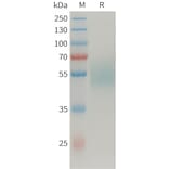 SDS-PAGE - Recombinant Human MICA Protein (Fc Tag) (A325032) - Antibodies.com