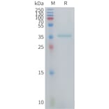 SDS-PAGE - Recombinant Human MIP-1 alpha/CCL3 Protein (Fc Tag) (A325033) - Antibodies.com
