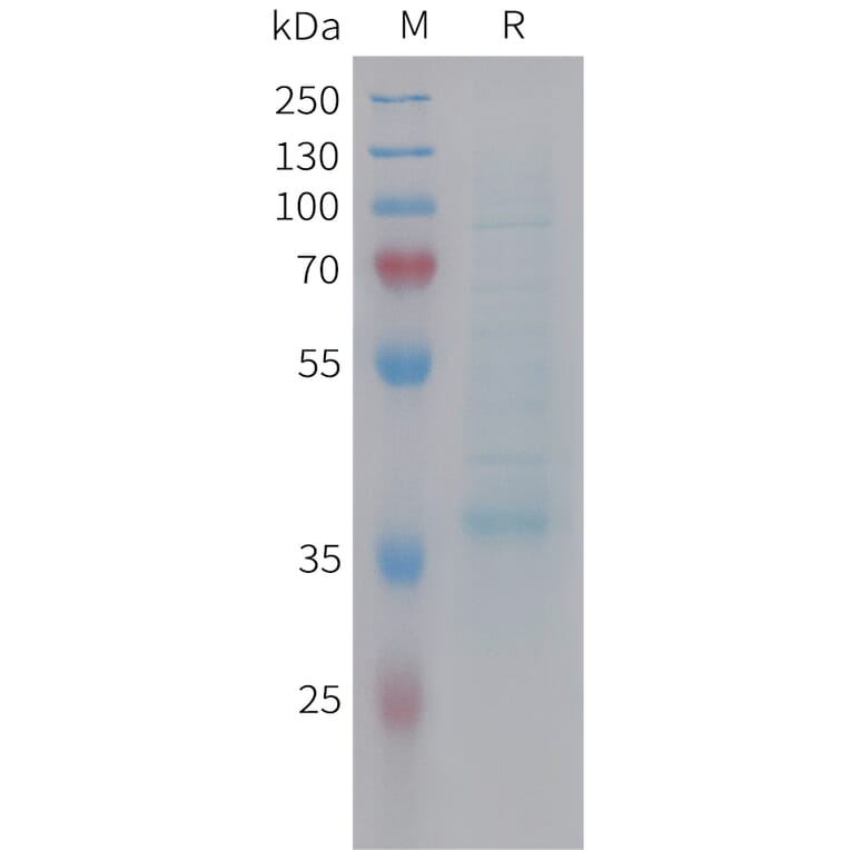 SDS-PAGE - Recombinant Human MIP-3 beta/CCL19 Protein (Fc Tag) (A325034) - Antibodies.com