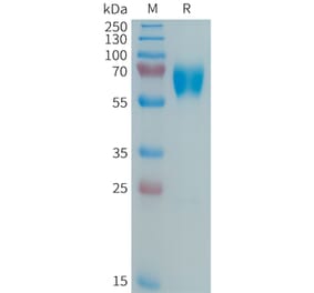 SDS-PAGE - Recombinant Human MMP8 Protein (6xHis Tag) (A325035) - Antibodies.com