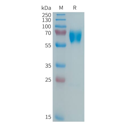 SDS-PAGE - Recombinant Human MMP8 Protein (6xHis Tag) (A325035) - Antibodies.com