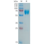 SDS-PAGE - Recombinant Human MMP8 Protein (6xHis Tag) (A325035) - Antibodies.com