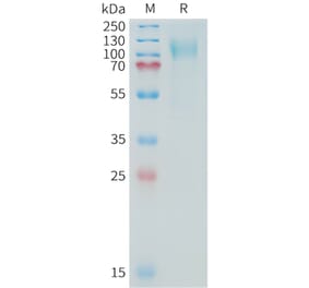 SDS-PAGE - Recombinant Human MUC16 Protein (10xHis Tag) (A325036) - Antibodies.com