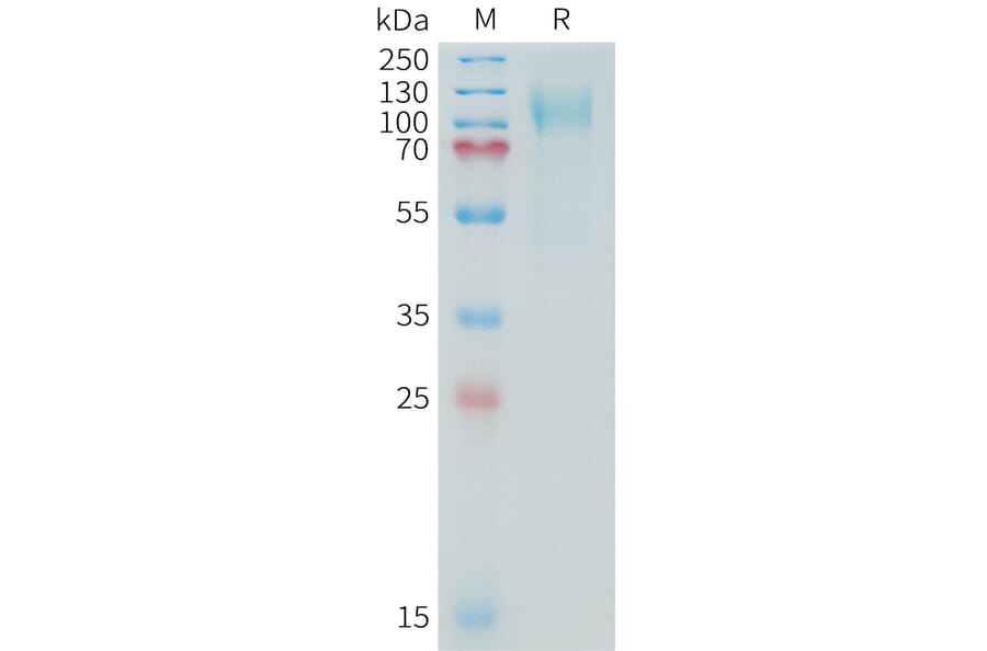 SDS-PAGE - Recombinant Human MUC16 Protein (10xHis Tag) (A325036) - Antibodies.com