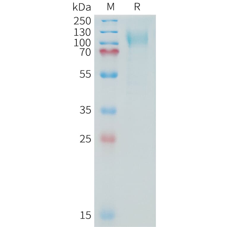 SDS-PAGE - Recombinant Human MUC16 Protein (10xHis Tag) (A325036) - Antibodies.com