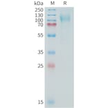 SDS-PAGE - Recombinant Human MUC16 Protein (10xHis Tag) (A325036) - Antibodies.com