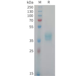 SDS-PAGE - Recombinant Human NECL-1 Protein (6xHis Tag) (A325038) - Antibodies.com