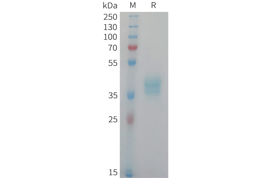 SDS-PAGE - Recombinant Human NECL-1 Protein (6xHis Tag) (A325038) - Antibodies.com