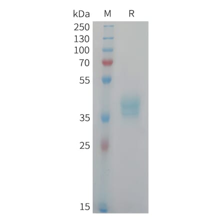 SDS-PAGE - Recombinant Human NECL-1 Protein (6xHis Tag) (A325038) - Antibodies.com