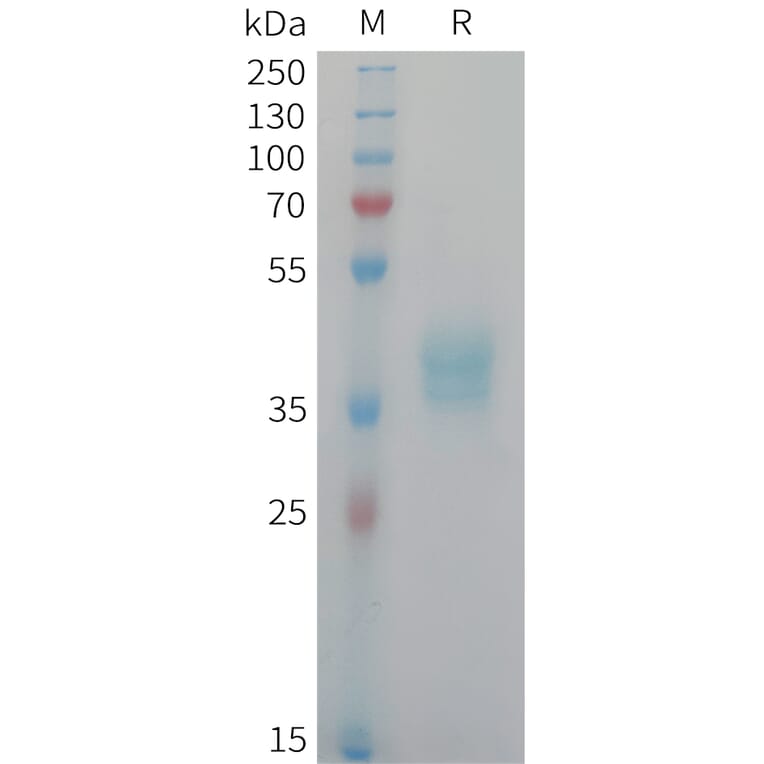 SDS-PAGE - Recombinant Human NECL-1 Protein (6xHis Tag) (A325038) - Antibodies.com