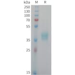 SDS-PAGE - Recombinant Human NECL-1 Protein (6xHis Tag) (A325038) - Antibodies.com