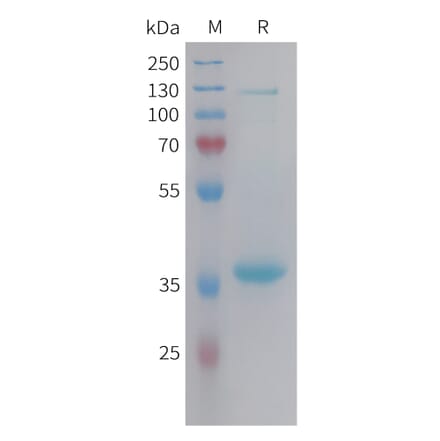 SDS-PAGE - Recombinant Human Neuropeptide Y Protein (Fc Tag) (A325039) - Antibodies.com