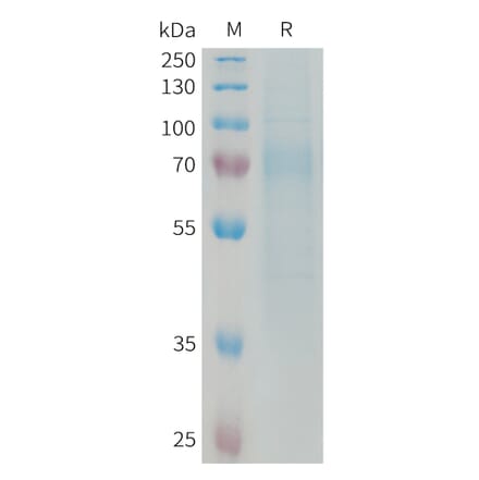 SDS-PAGE - Recombinant Human Nogo Receptor Protein (6xHis Tag) (A325043) - Antibodies.com
