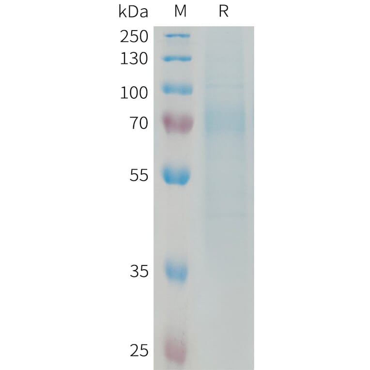 SDS-PAGE - Recombinant Human Nogo Receptor Protein (6xHis Tag) (A325043) - Antibodies.com