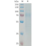 SDS-PAGE - Recombinant Human Nogo Receptor Protein (6xHis Tag) (A325043) - Antibodies.com