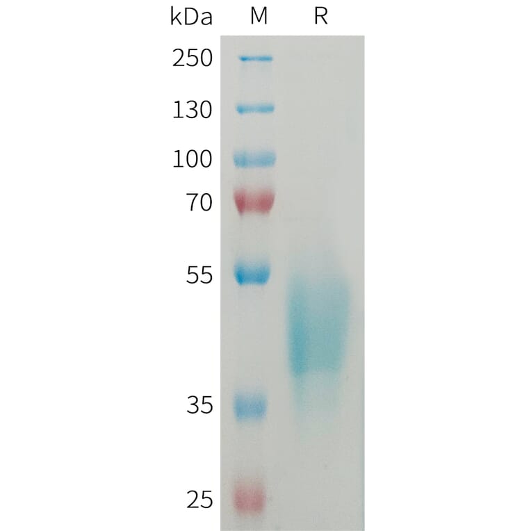 SDS-PAGE - Recombinant Human OSCAR/Osteoclast-Associated Receptor Protein (6xHis Tag) (A325044) - Antibodies.com
