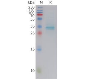 SDS-PAGE - Recombinant Human Parathyroid Hormone Protein (Fc Tag) (A325045) - Antibodies.com