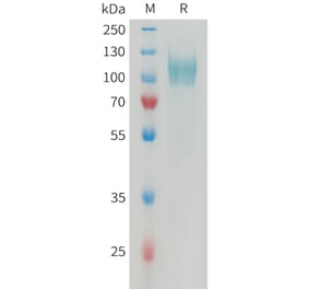 SDS-PAGE - Recombinant Human PDGFR alpha Protein (6xHis Tag) (A325046) - Antibodies.com