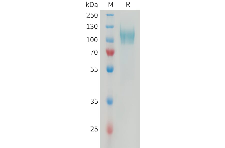 SDS-PAGE - Recombinant Human PDGFR alpha Protein (6xHis Tag) (A325046) - Antibodies.com