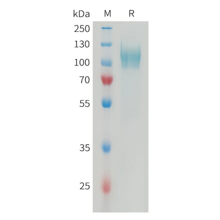 SDS-PAGE - Recombinant Human PDGFR alpha Protein (6xHis Tag) (A325046) - Antibodies.com